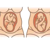 Zwei Darstellungen eines schwangeren Bauches. Links liegt das Baby mit dem Kopf nach unten, rechts mit dem Kopf nach oben. Wie oft dreht sich das Baby im Bauch am Tag?