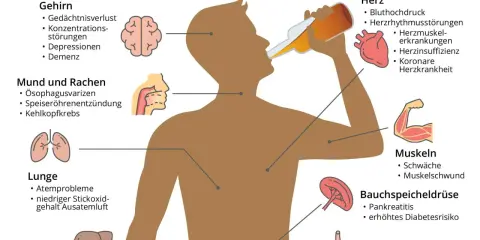 Illustration zeigt Symptome von Alkoholsucht: Gehirn, Herz, Lunge, Leber, Magen, Bauchspeicheldrüse, Muskeln, Mund & Rachen. Die 10 Stufen des Alkoholismus sind hier nicht dargestellt.