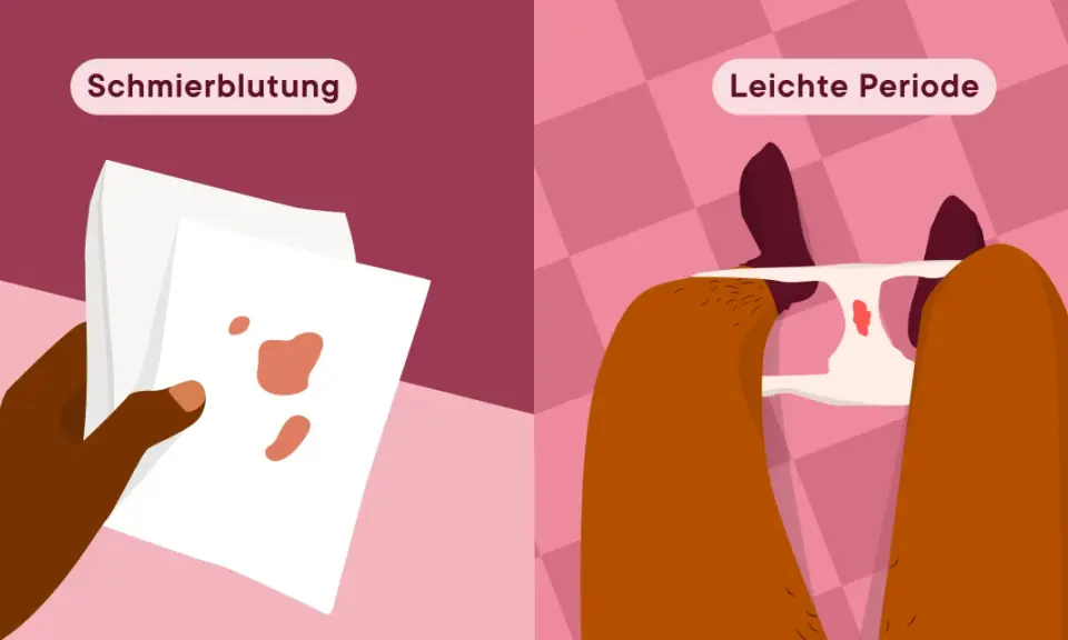 Vergleich: Minimale hellrote Blutung (Schmierblutung) im 3. Trimester vs. leichte Periode.